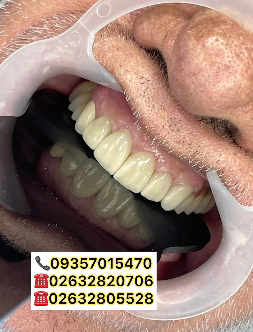 مطب دندانپزشکی تخصصی دکتر زینب حیدری پور - تصویر 6