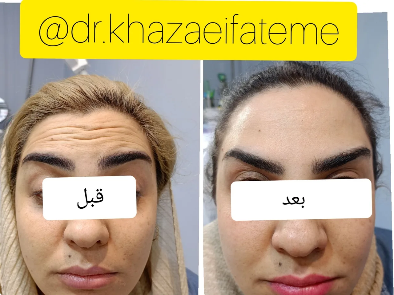 کلینیک زیبایی و لیزر دکتر فاطمه خزایی - تصویر 3