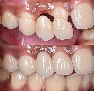دندانپزشکی دکتر افشین همتی