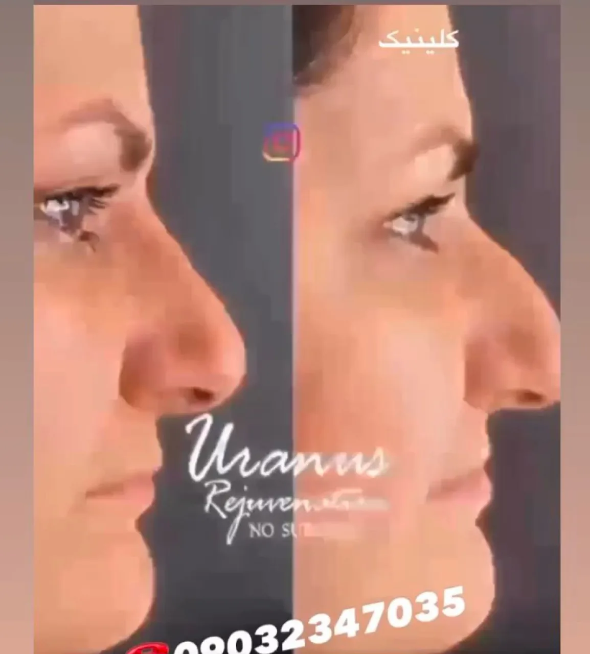 کلینیک زیبایی اورانوس. ، دکتر رستمی - تصویر 4