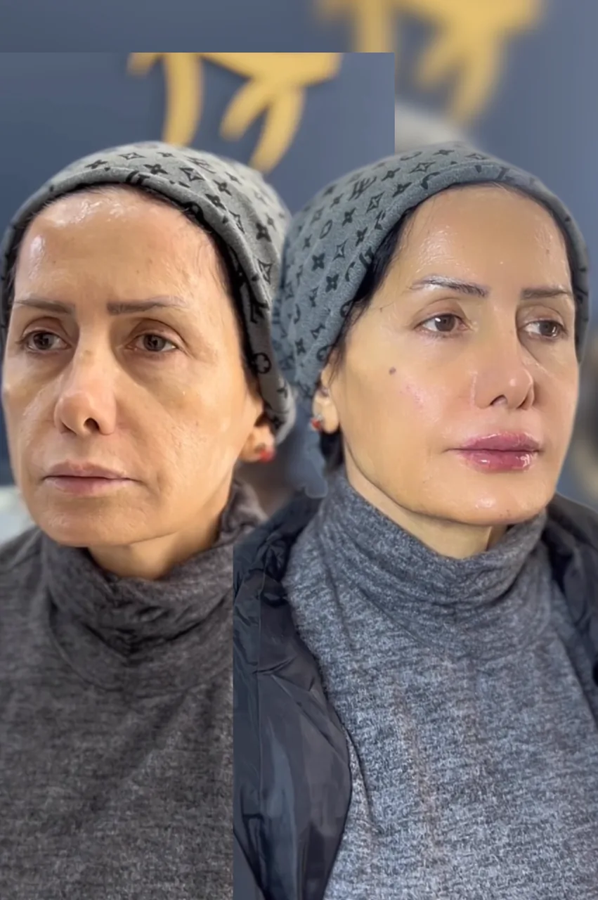 کلینیک زیبایی دکتر فاطمه کمائی - تصویر 2