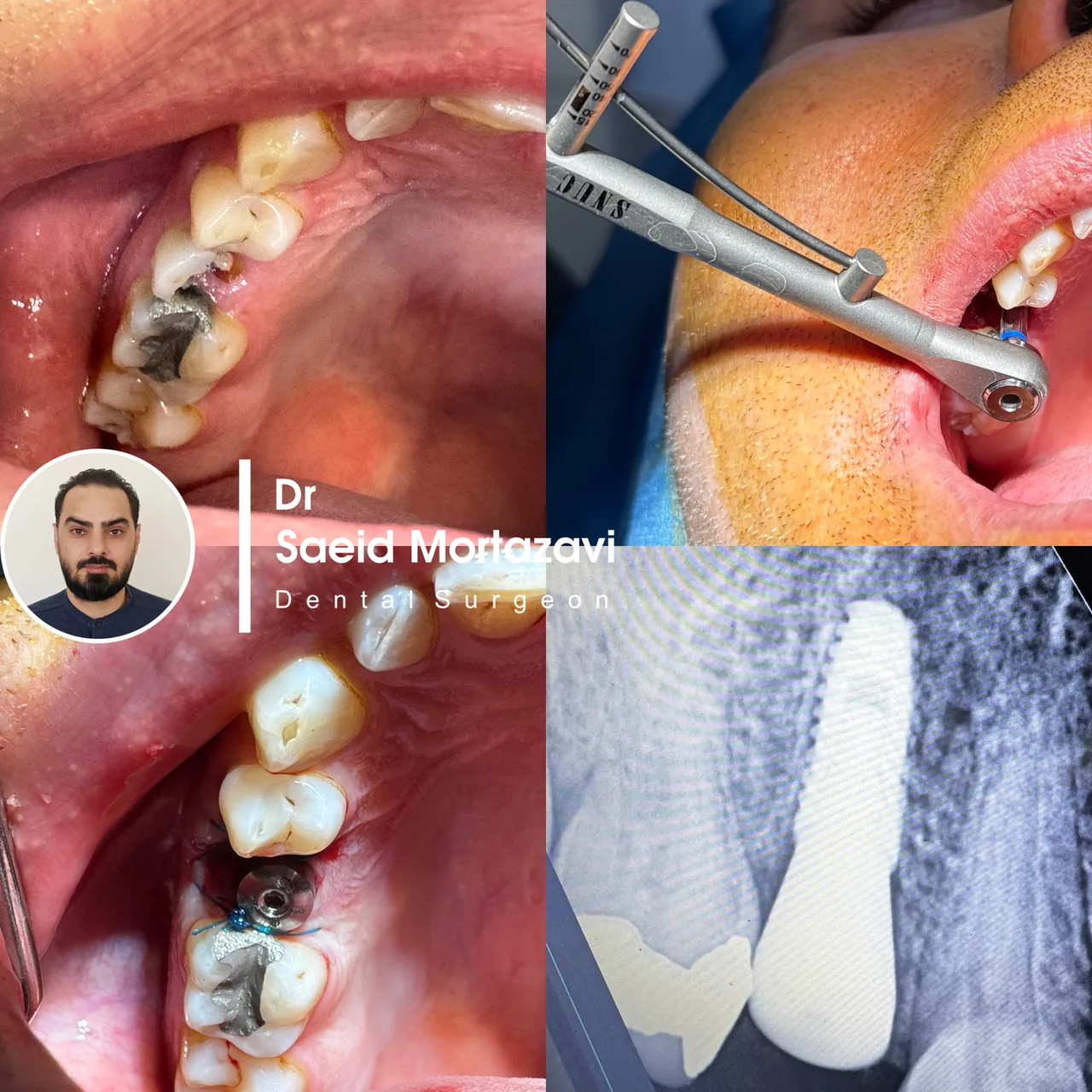 دندانپزشکی دکتر سعید مرتضوی و دکتر فرناز همتی - دندانپزشک در کرج - تصویر 3