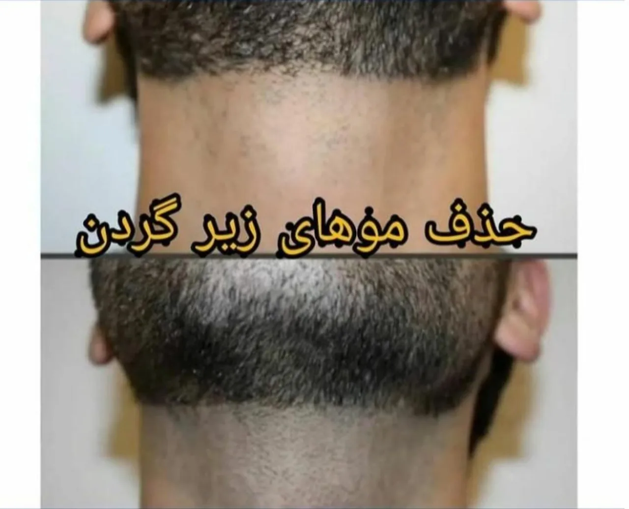 لیزر پوست و مو و زیبایی دکتر آقاجانی - تصویر 2