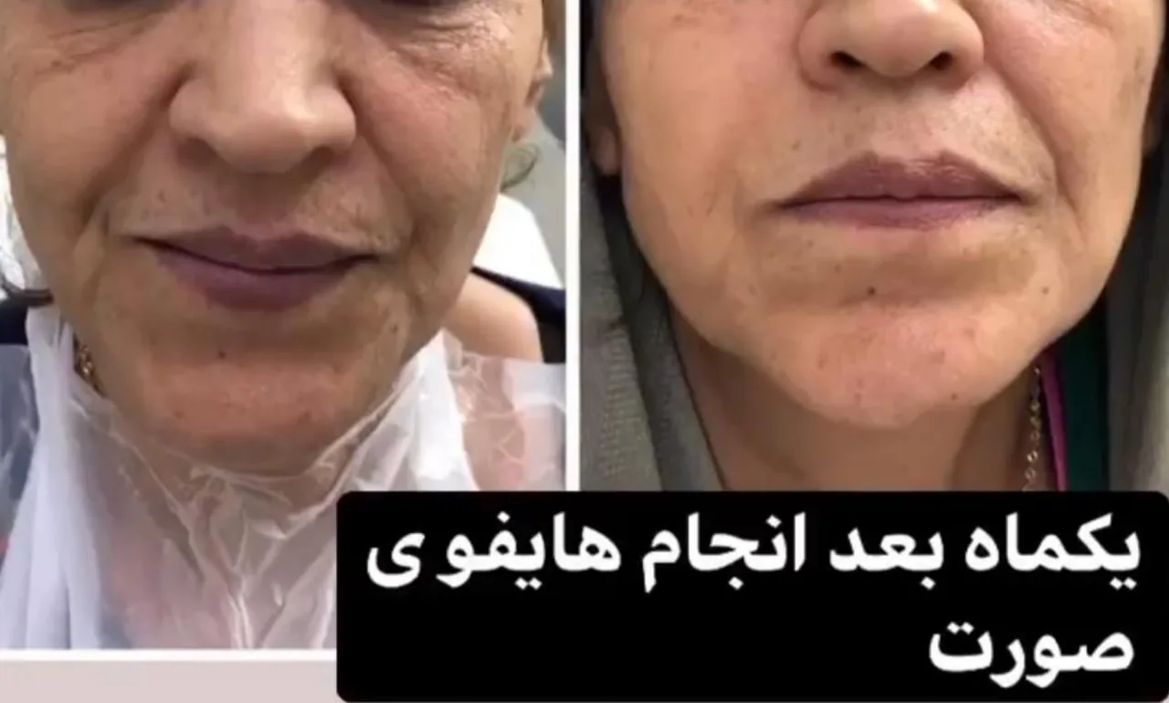 لیزر پوست و مو و زیبایی دکتر آقاجانی - تصویر 4