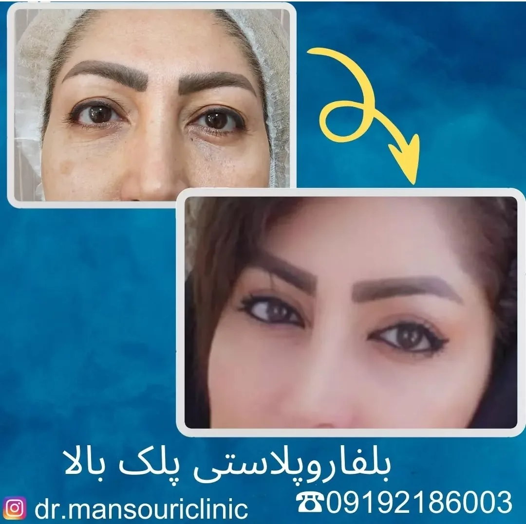 کلینیک پوست، مو و زیبایی دکتر منصوری - تصویر 2