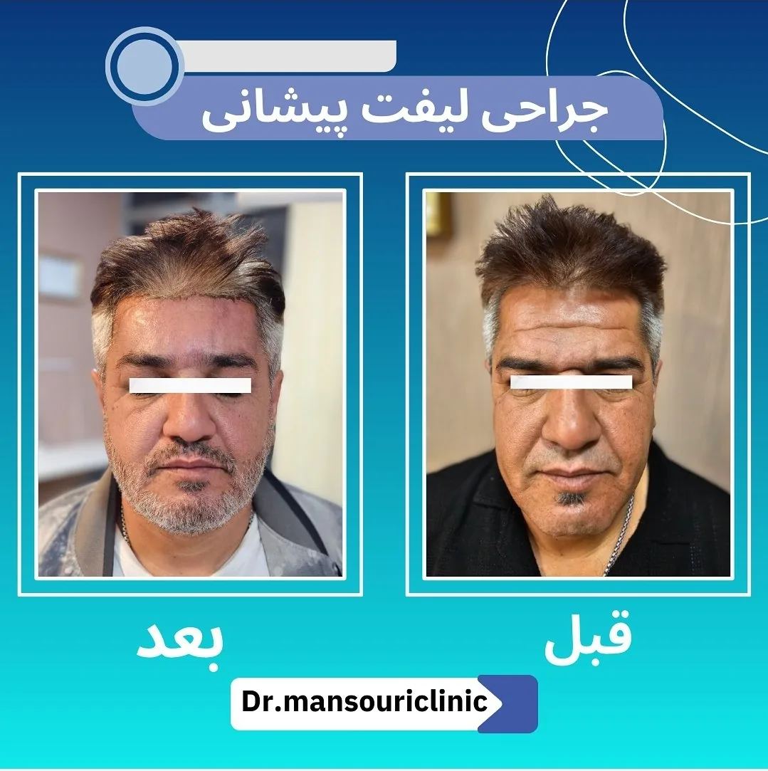 کلینیک پوست، مو و زیبایی دکتر منصوری - تصویر 3