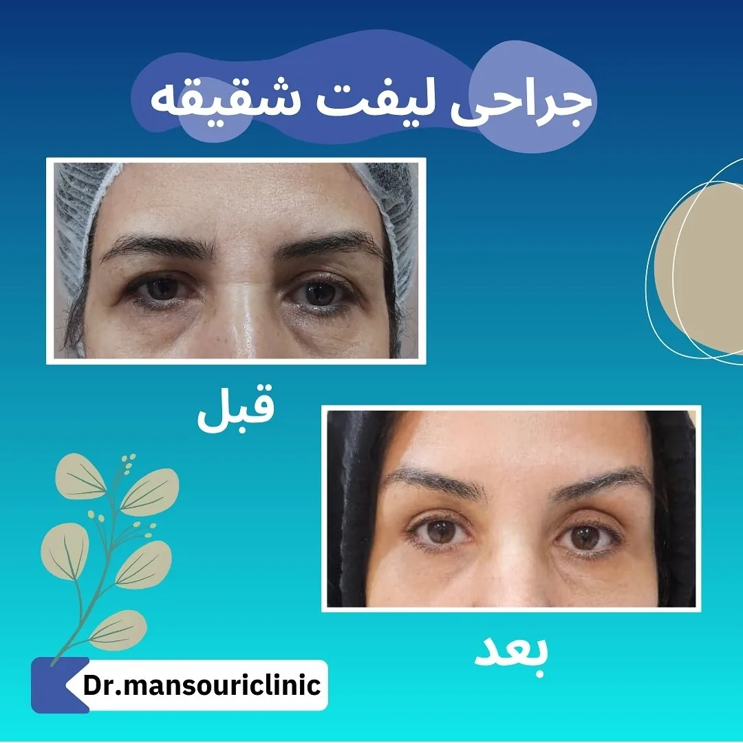 کلینیک پوست، مو و زیبایی دکتر منصوری - تصویر 4
