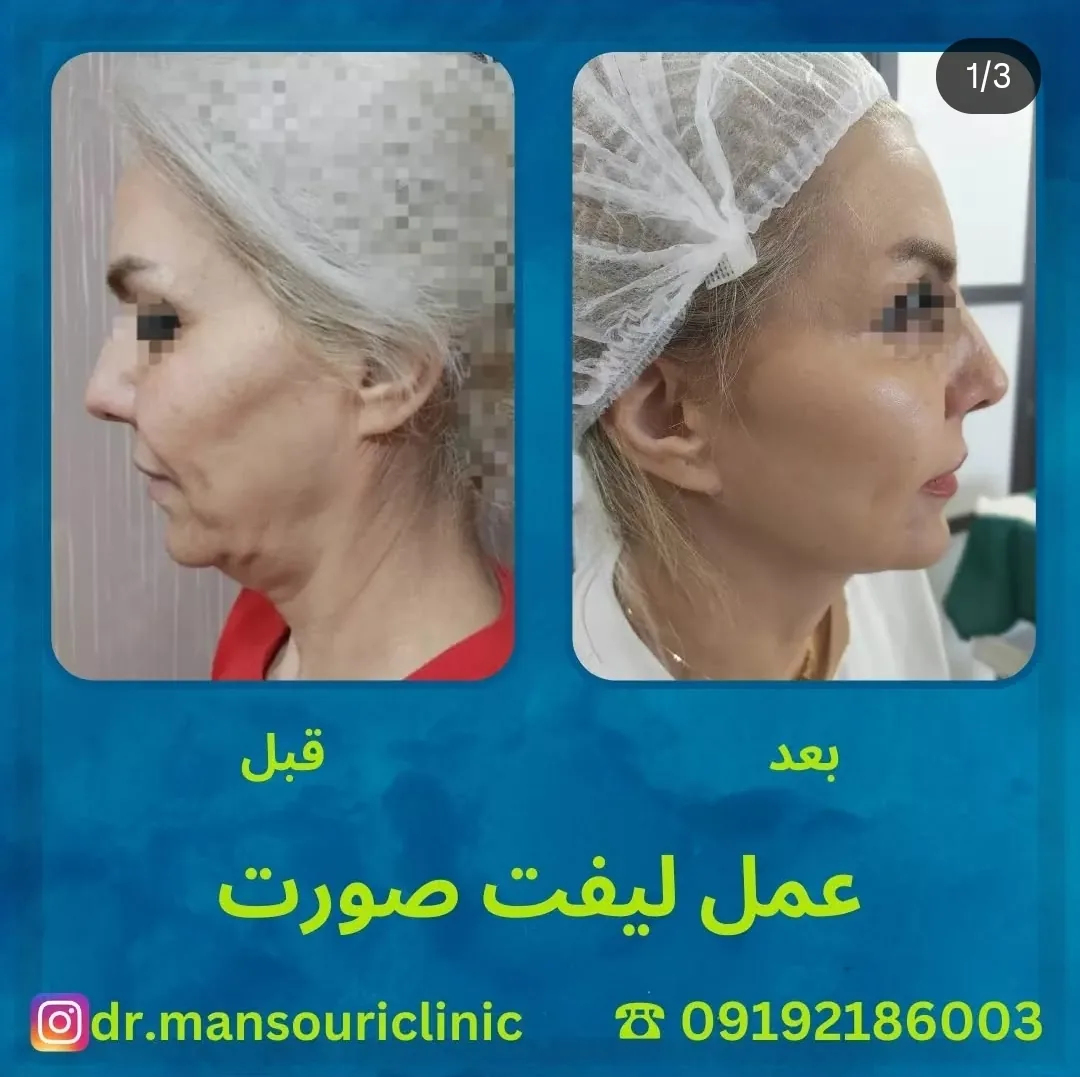 کلینیک پوست، مو و زیبایی دکتر منصوری - تصویر 5