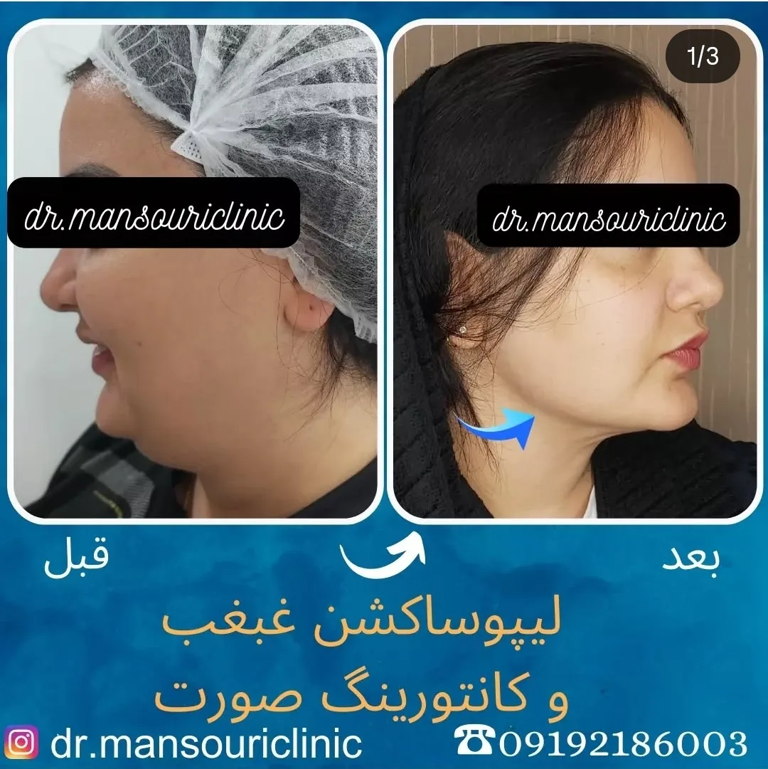 کلینیک پوست، مو و زیبایی دکتر منصوری - تصویر 6