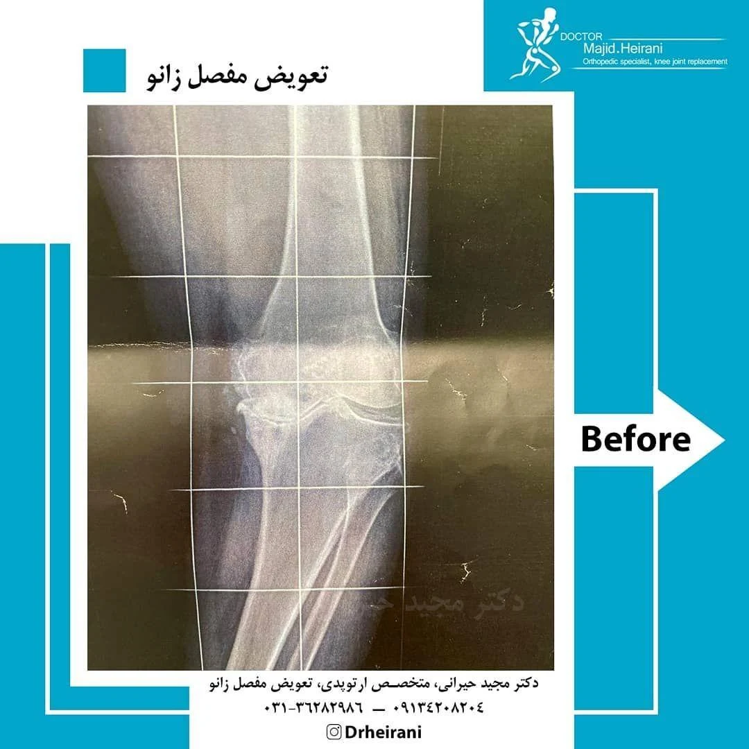 دکتر مجید حیرانی - تصویر 4