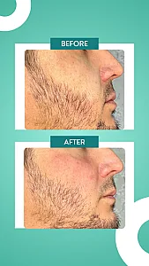مطب زیبایی دکتر مینا حقانی