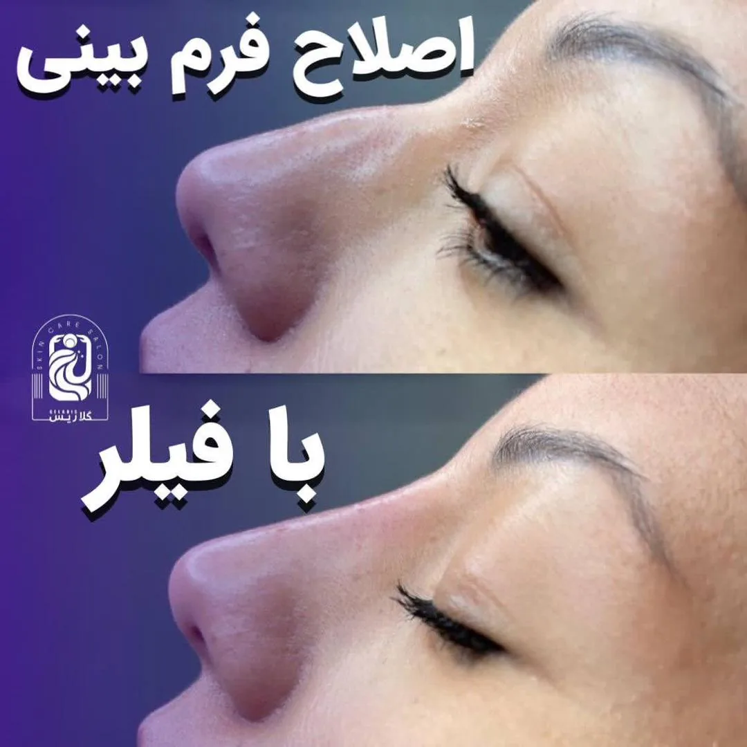 مرکز لیزر کلینیک زیبایی ماساژ گلاریس - تصویر 2