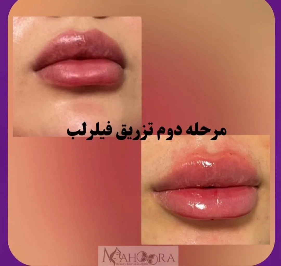 کلینیک زیبایی و مرکز لیزر ماهورا - تصویر 4