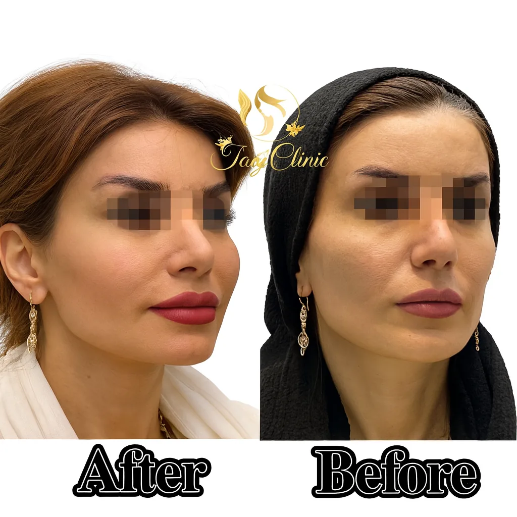 کلینیک پوست و زیبایی ولاغری تاج عظیمیه - تصویر 2