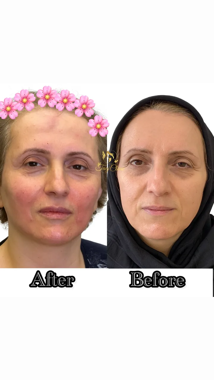 کلینیک پوست و زیبایی ولاغری تاج عظیمیه - تصویر 3