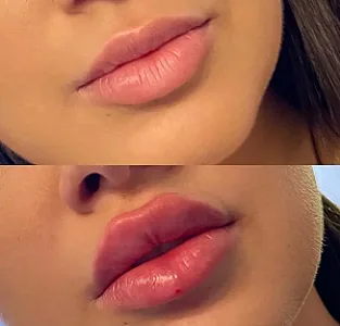 مطب پوست مو زیبایی السا