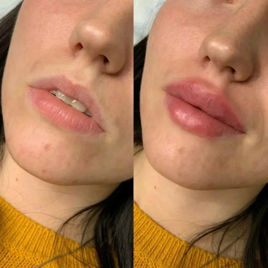 مطب پوست مو زیبایی السا - تصویر 4