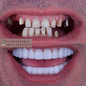 دندان پزشکی دکتر فروغ رمضانپور
