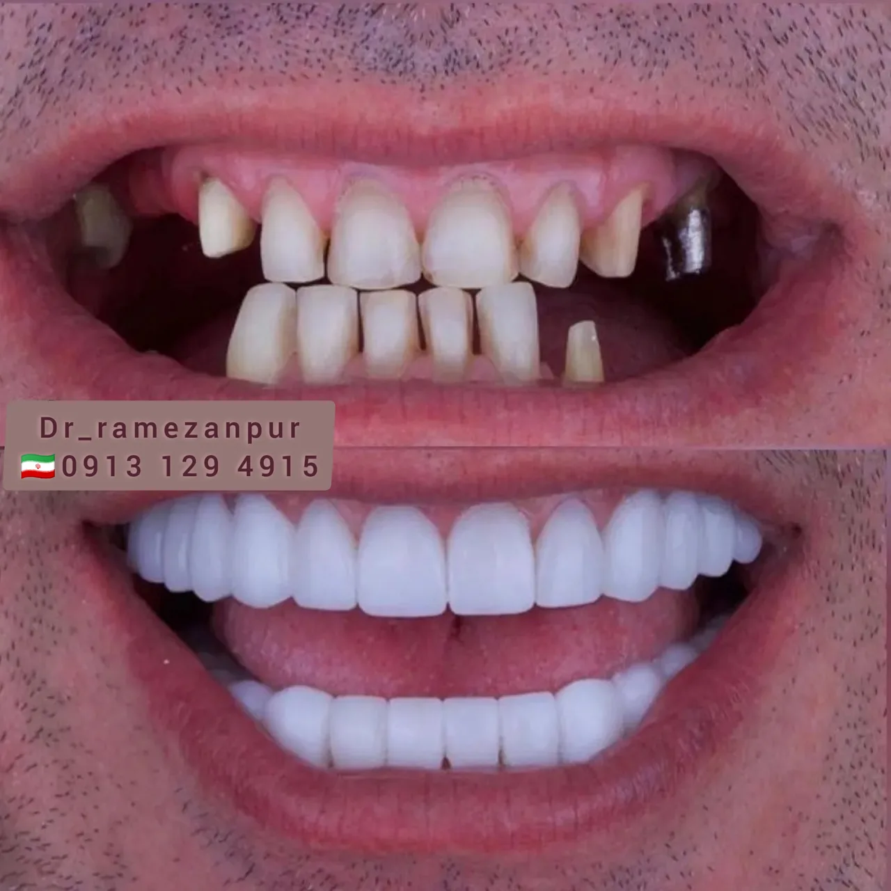 دندان پزشکی دکتر فروغ رمضانپور
