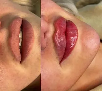 کلینیک زیبایی برنا