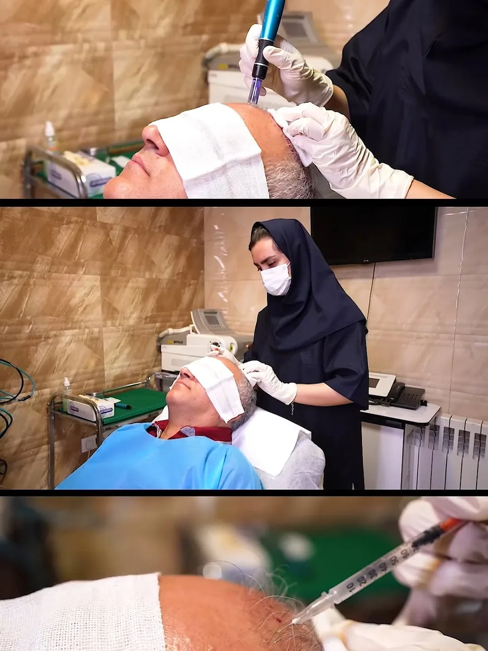 کلینیک زیبایی و کاشت مو آفتاب - تصویر 3