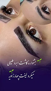 کاشت ابرو پرتراکم پارمیدا