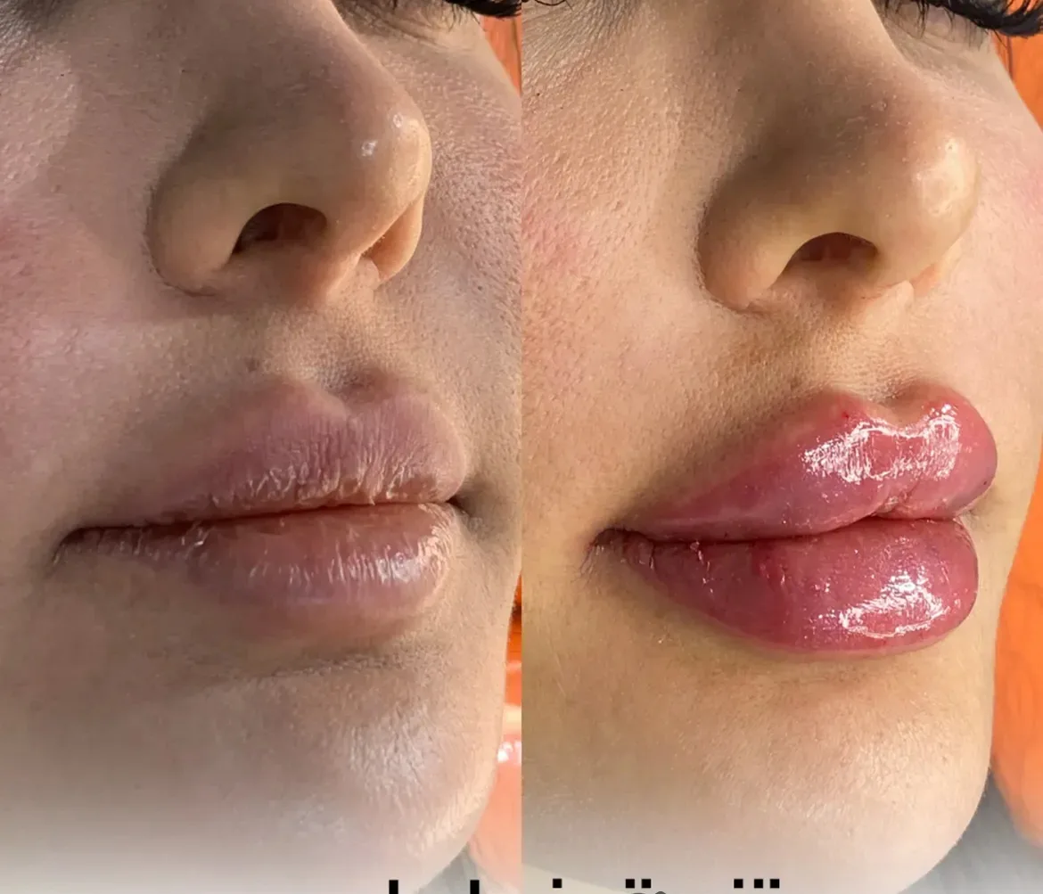 کلینیک تخصصی لیزر پوست مو مه سیما