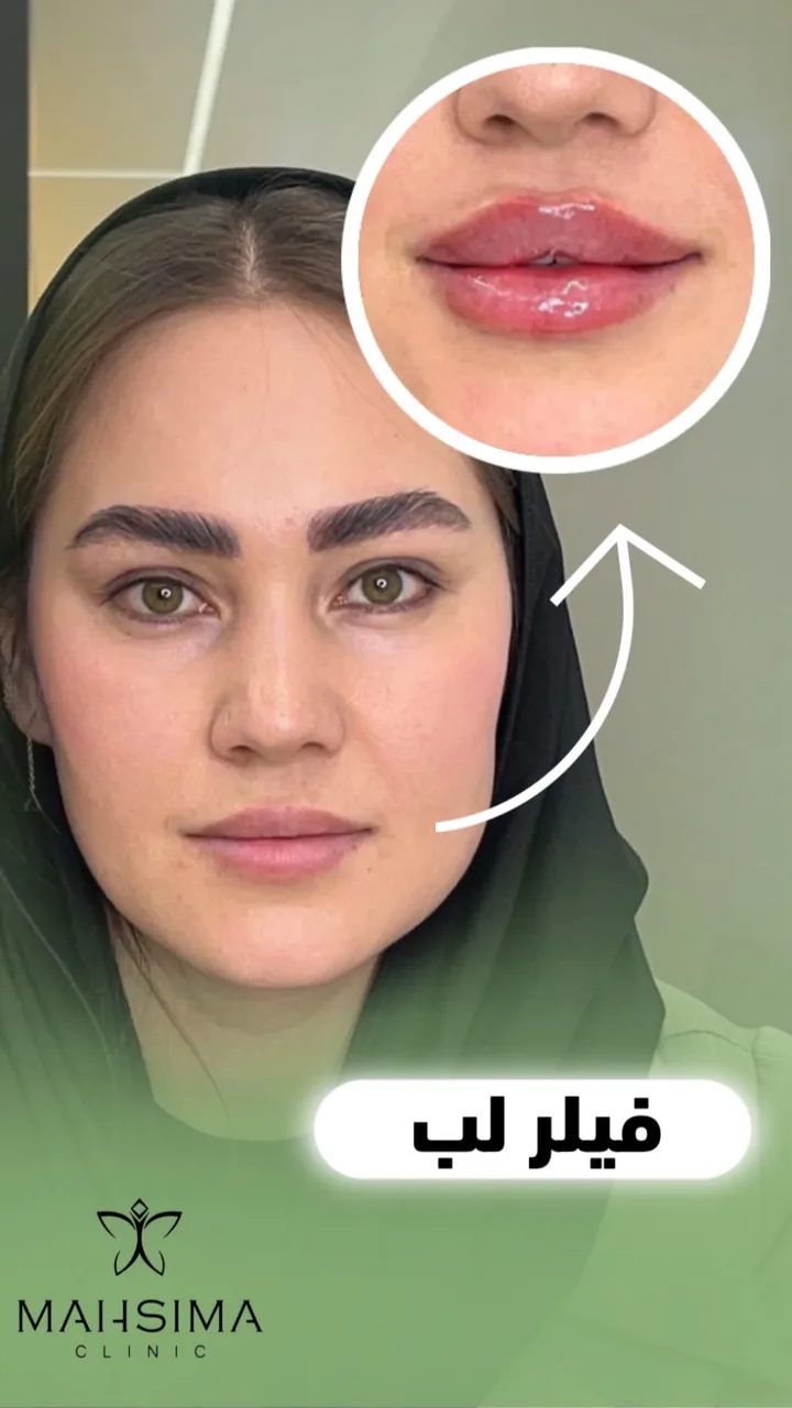 کلینیک تخصصی لیزر پوست مو مه سیما - تصویر 2