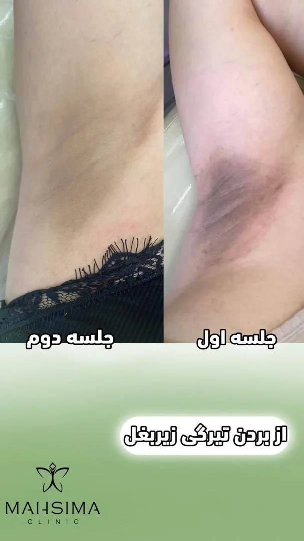 کلینیک تخصصی لیزر پوست مو مه سیما - تصویر 3