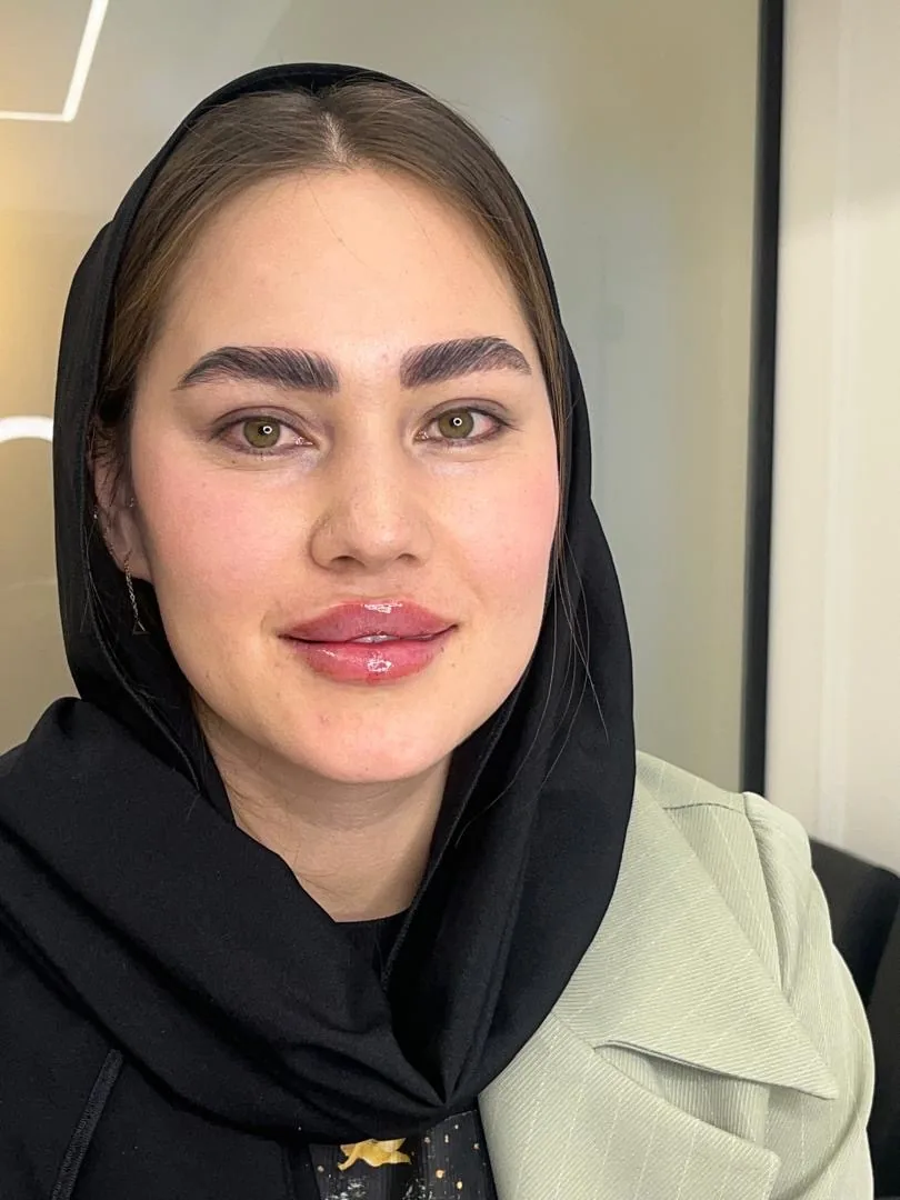 کلینیک تخصصی لیزر پوست مو مه سیما - تصویر 5