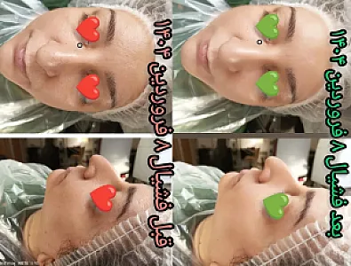 فشیال رحیمه بلوچ