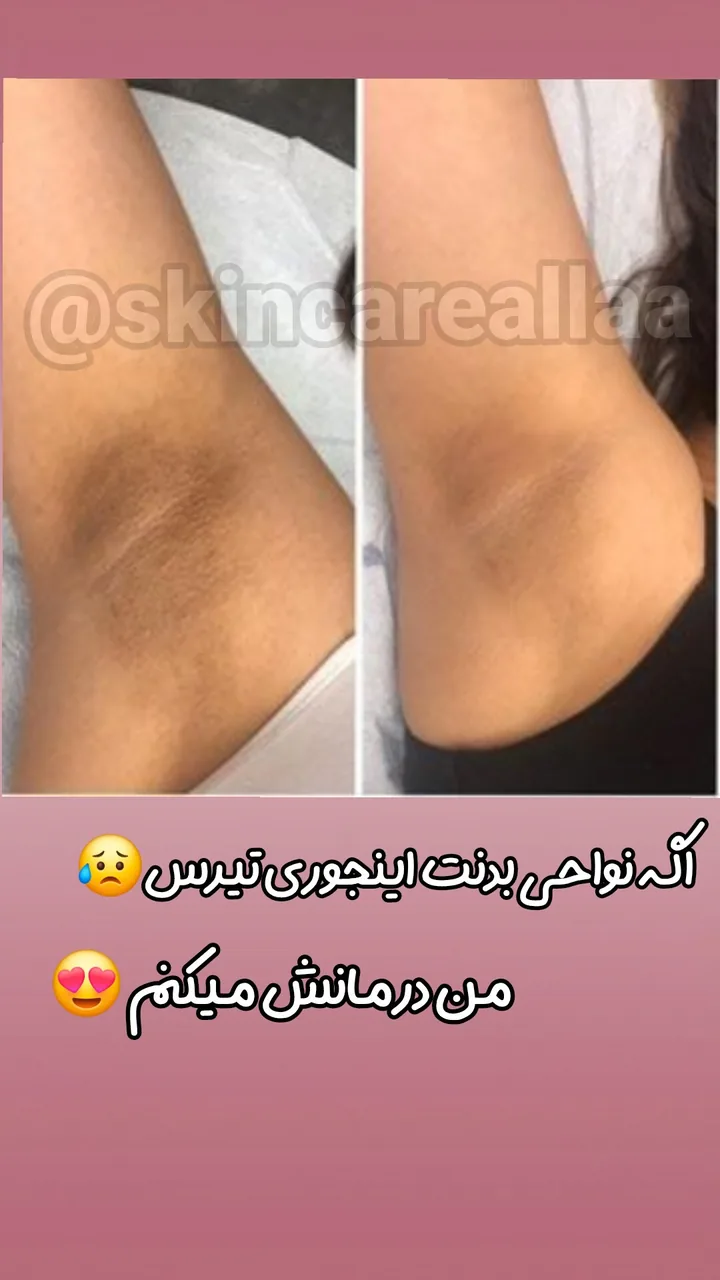کلینیک پاکسازی وفیشیال پوست آلا بانو - تصویر 2