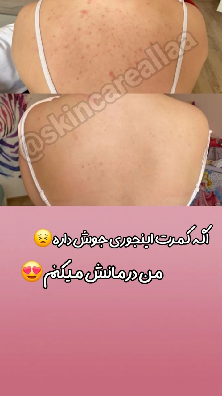کلینیک پاکسازی وفیشیال پوست آلا بانو - تصویر 3