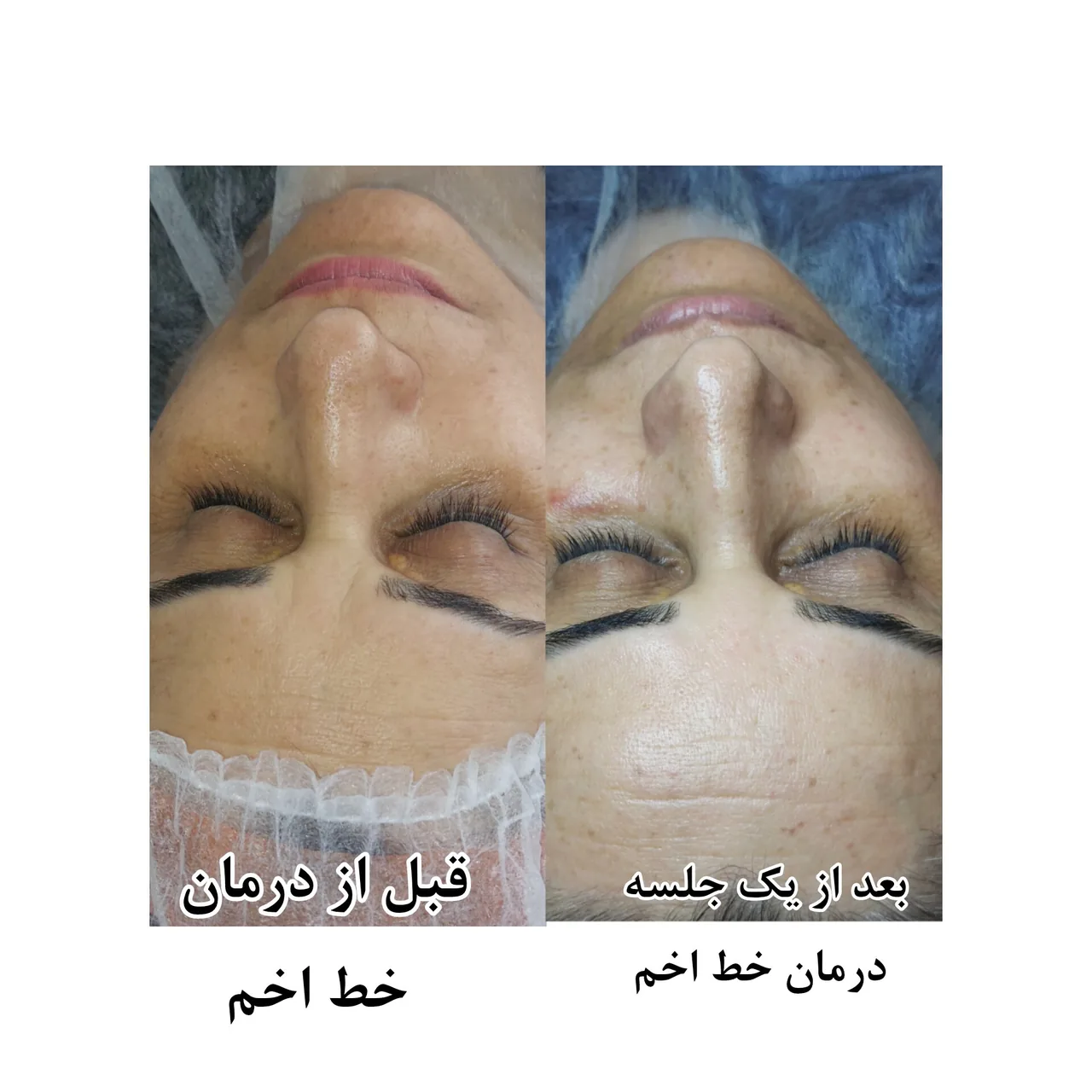 کلینیک پاکسازی وفیشیال پوست آلا بانو - تصویر 5