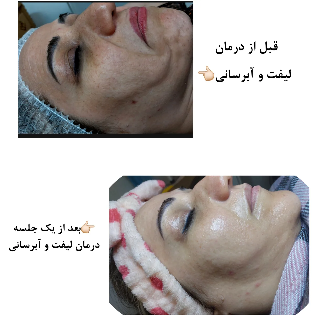 کلینیک پاکسازی وفیشیال پوست آلا بانو - تصویر 6