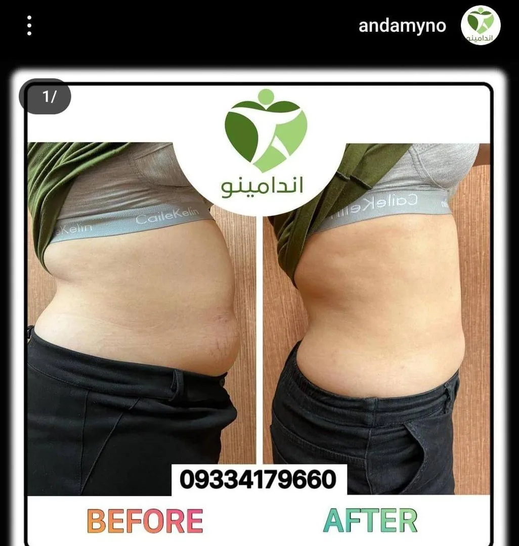 کلینیک لاغری اندامینو