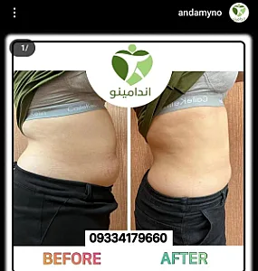 کلینیک لاغری اندامینو