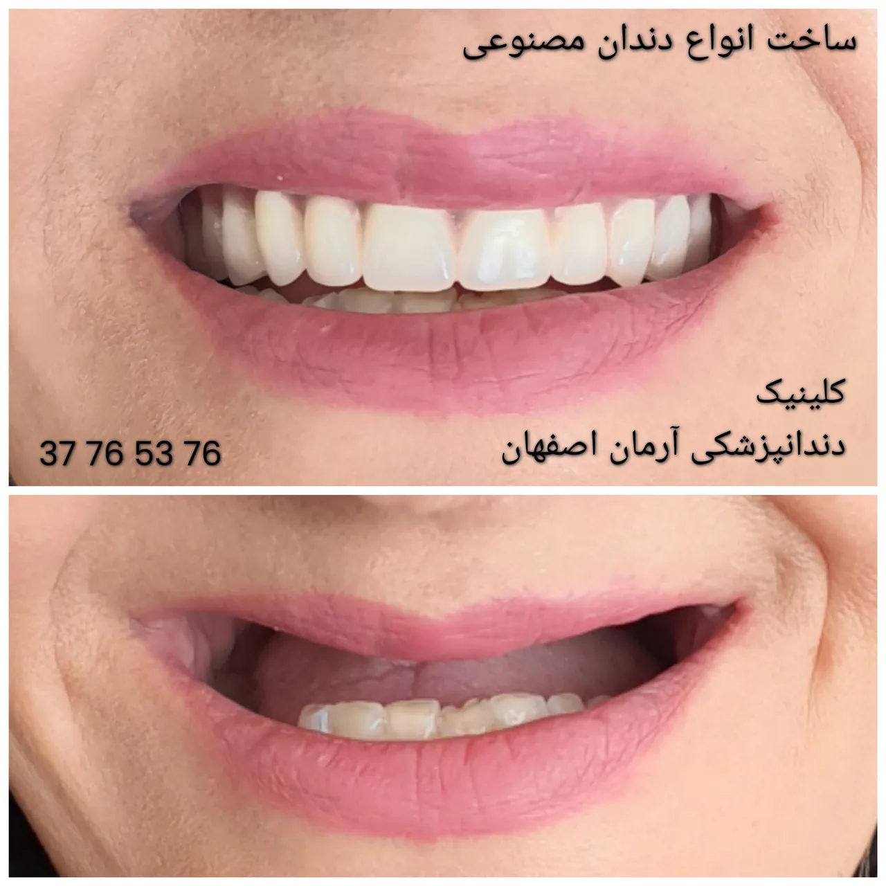 دندانپزشکی آرمان اصفهان - تصویر 4