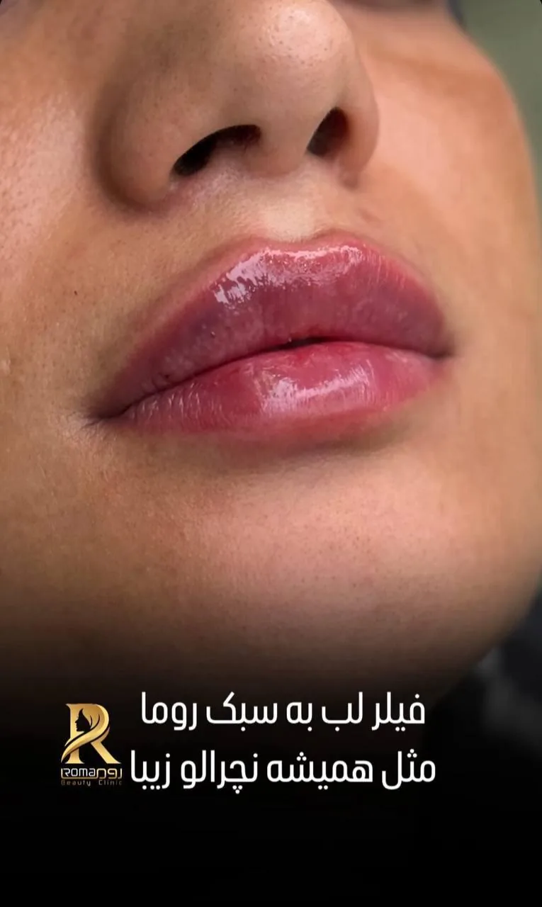 کلینیک روما