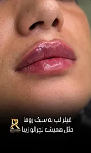 کلینیک روما