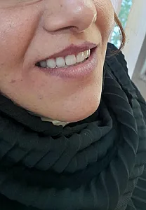 دندانسازی الماس شعبه ۱