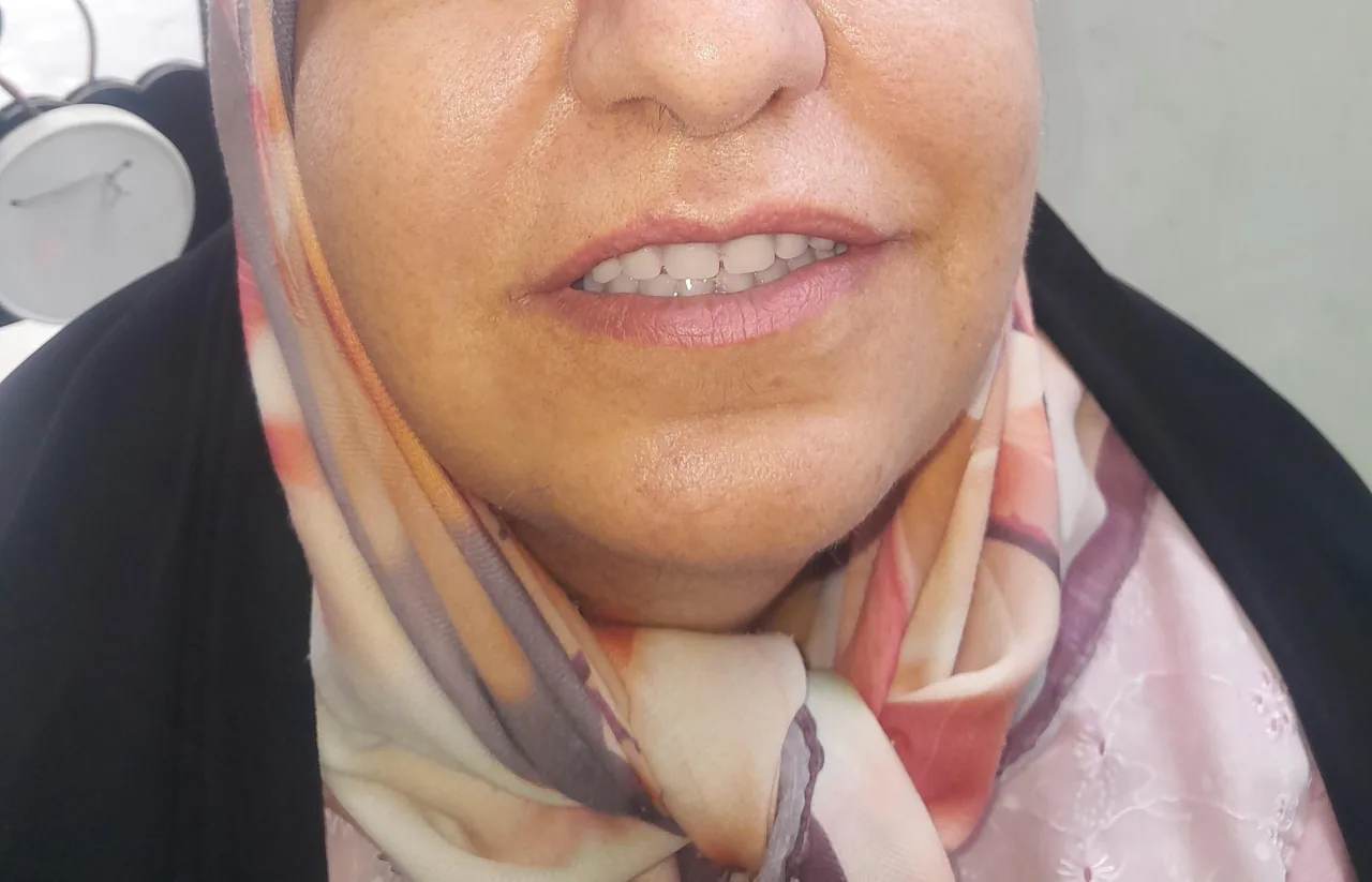 دندانسازی الماس شعبه ۱ - تصویر 4