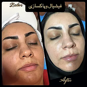 کلنیک تخصصی پوست مو لیزر جراحی رز