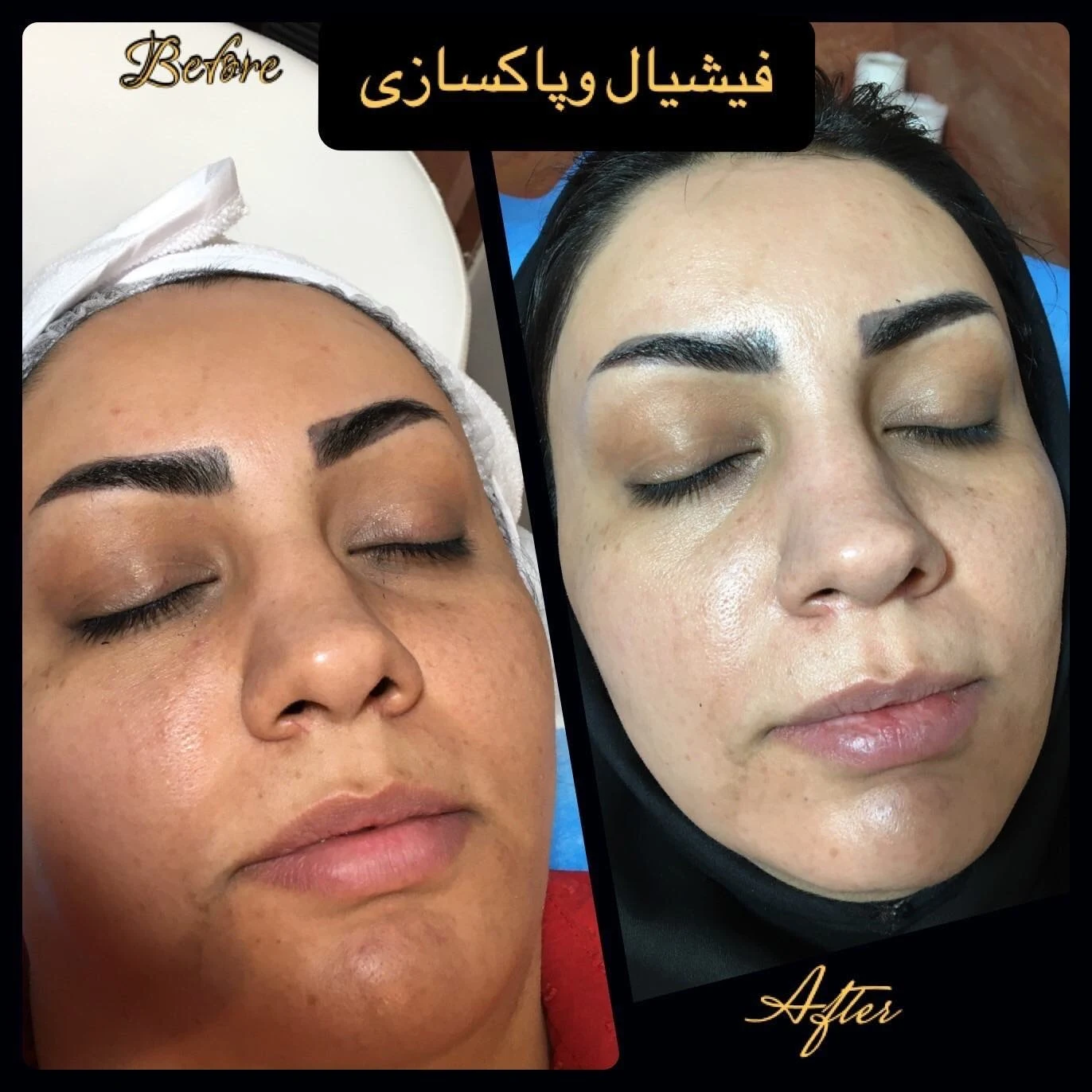 کلنیک تخصصی پوست مو لیزر جراحی رز - درمانگاه در اصفهان