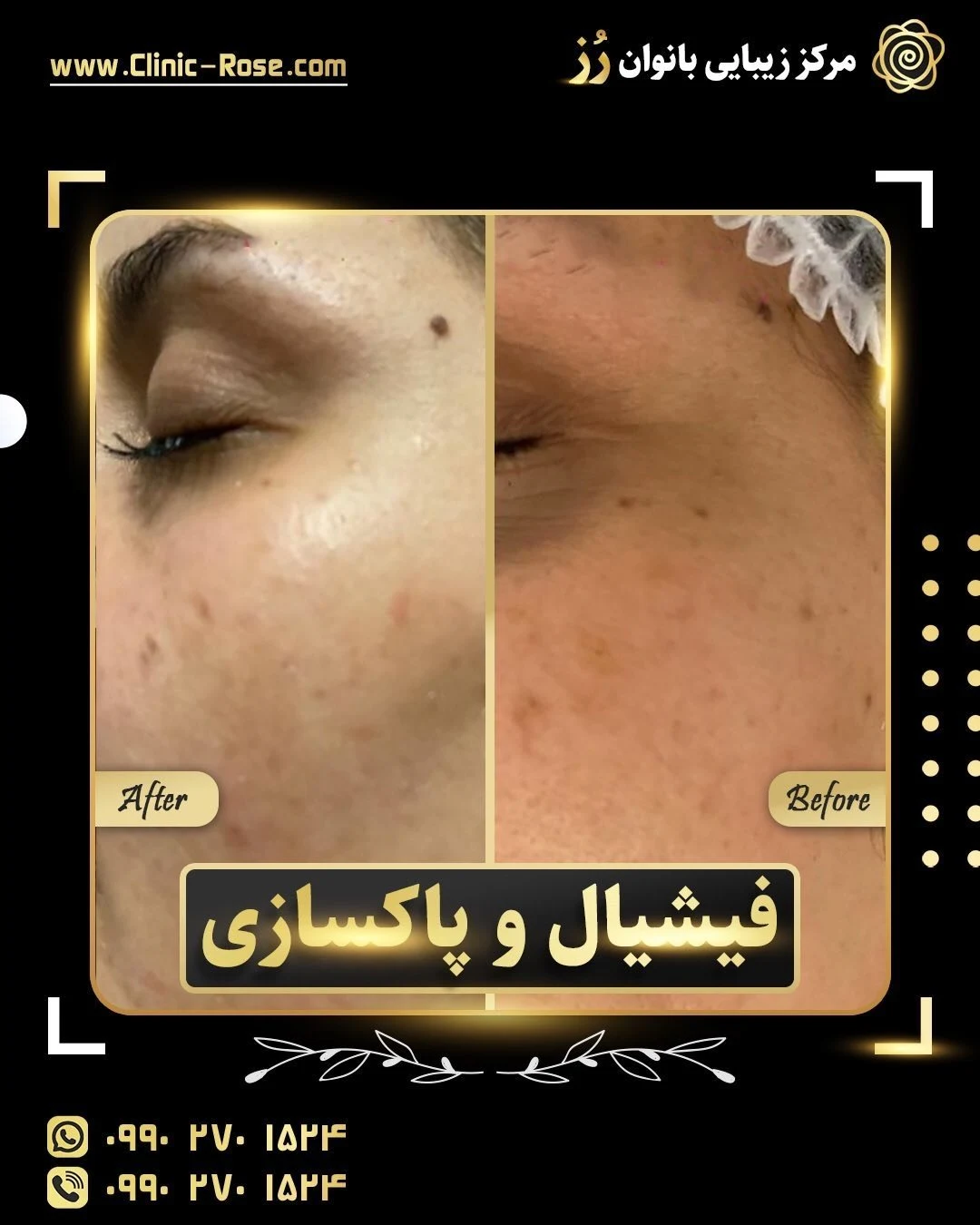 کلنیک تخصصی پوست مو لیزر جراحی رز - درمانگاه در اصفهان - تصویر 2