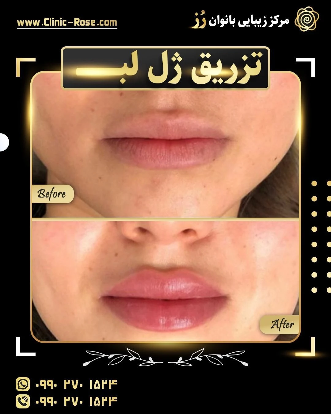 کلنیک تخصصی پوست مو لیزر جراحی رز - درمانگاه در اصفهان - تصویر 4