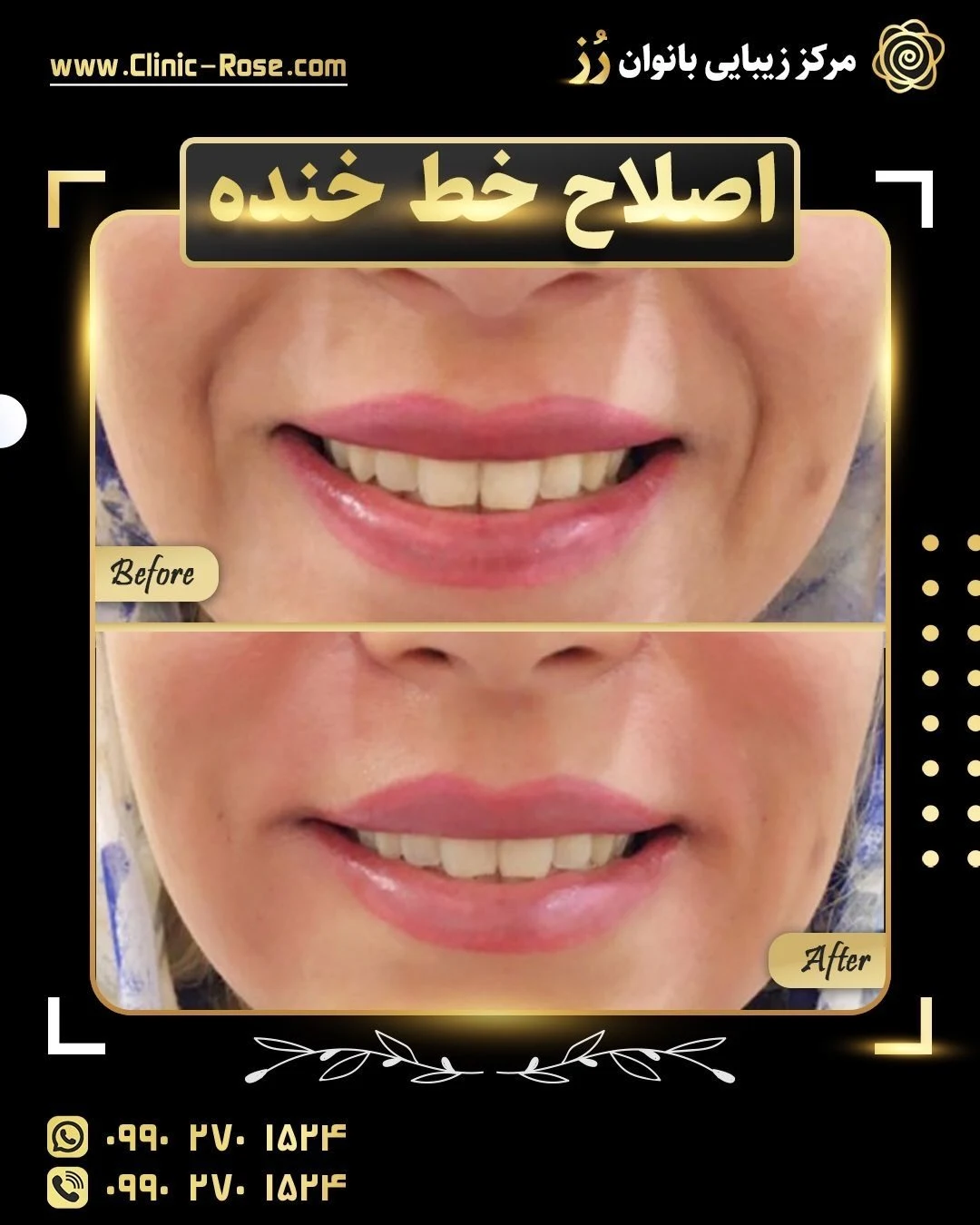 کلنیک تخصصی پوست مو لیزر جراحی رز - درمانگاه در اصفهان - تصویر 5