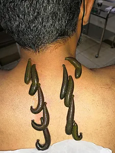 طب سنتی افرا