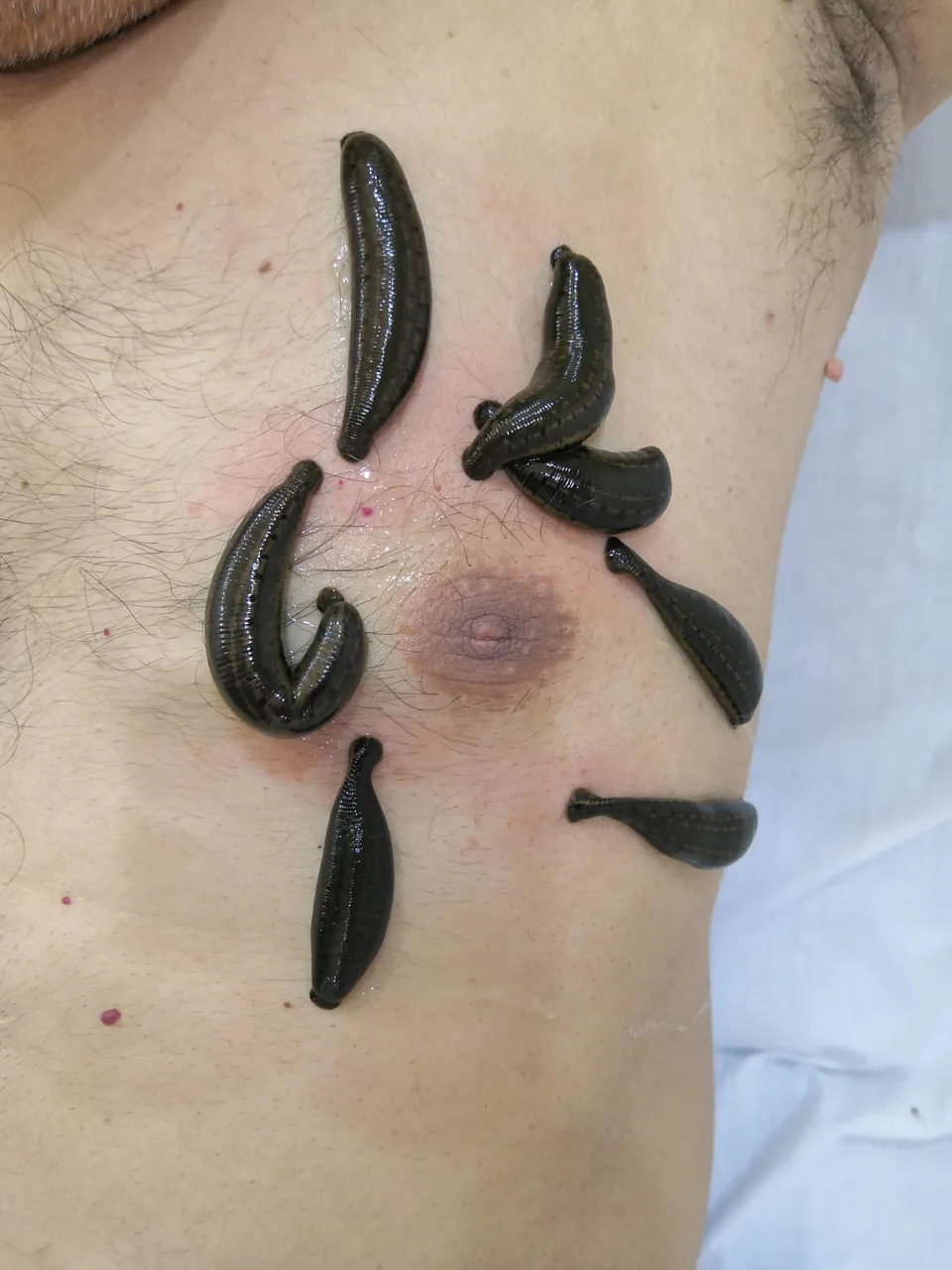 طب سنتی افرا - تصویر 3