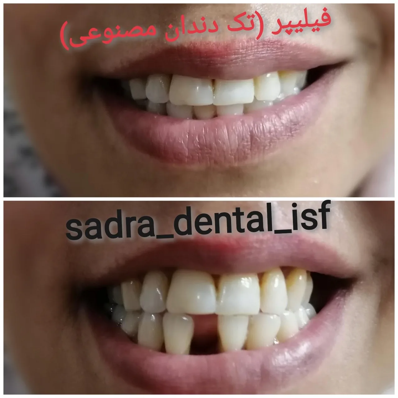 دندانسازی صدرا - تصویر 2
